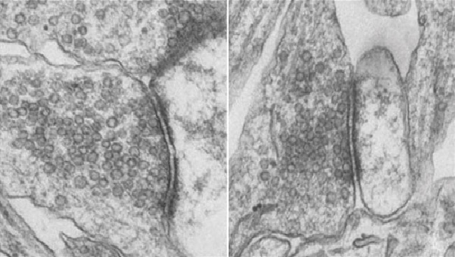 Tiny, bubble-like compartments known as vesicles. 