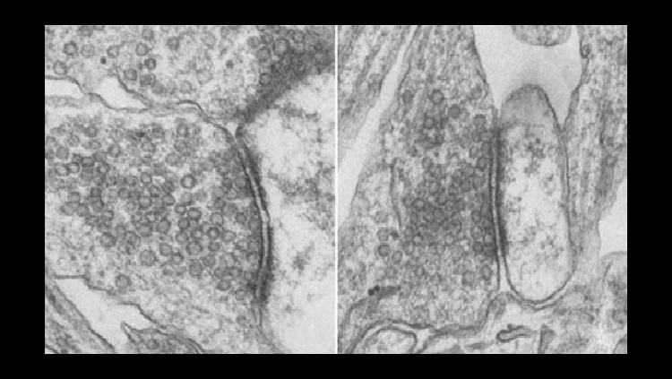 Tiny, bubble-like compartments known as vesicles. 