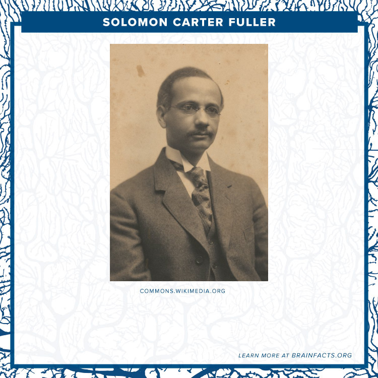 Brain Byte of Solomon Carter Fuller