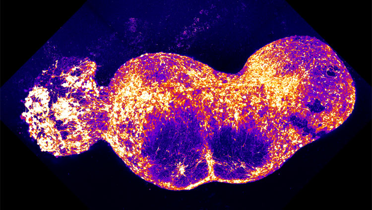 An organoid representing the dorsal root ganglion