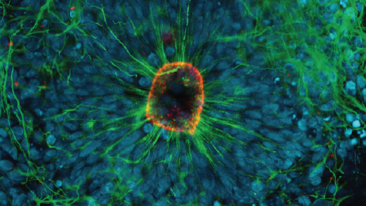 This mini-model lets us watch the birth of new brain cells.
