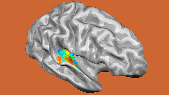 Functional magnetic resonance imaging (fMRI) noninvasively measures brain activity changes deep inside the brain. Scientists used fMRI to measure changes in brain activity in the auditory cortex as people listened to sound frequencies, ranging from low (20 Hz) to high (8000 Hz), displayed in the red-to-blue color scale indicated above. 