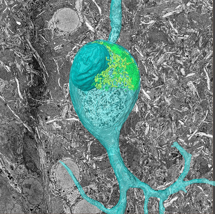 3D electron microscopy