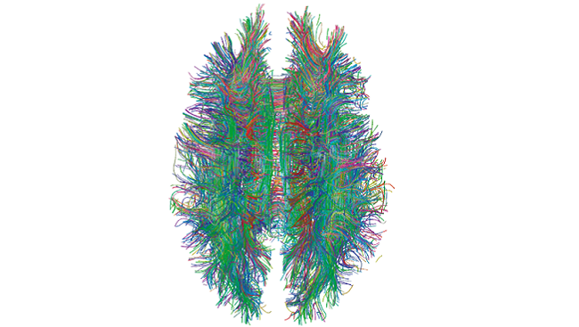 Scientists have previously been able to map the brain using technology such as MRI tractography, used here to map white matter tracts in the human brain. 