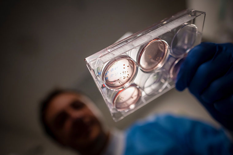 Stem cells