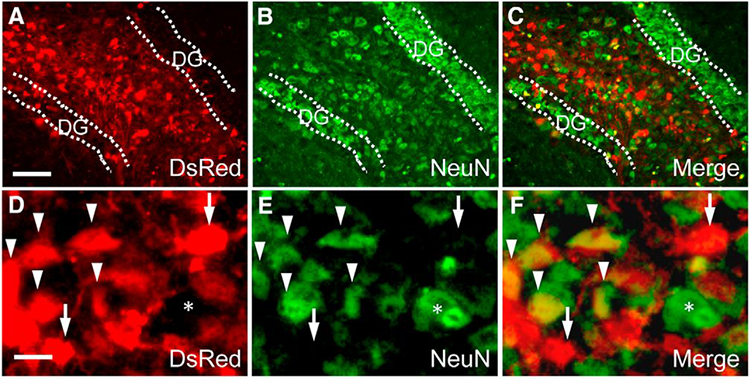 Image DsRed and NeuN