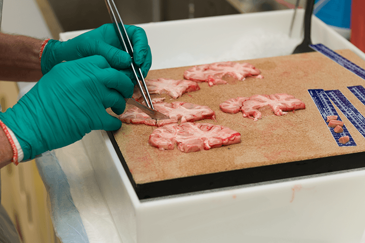 Researcher dissecting cross sections of a human brain