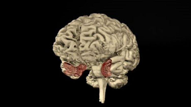 Image of brain