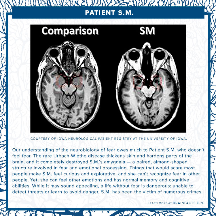 Patient sm Brain byte