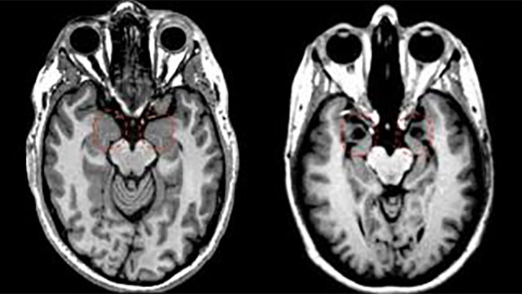 Human brain divided