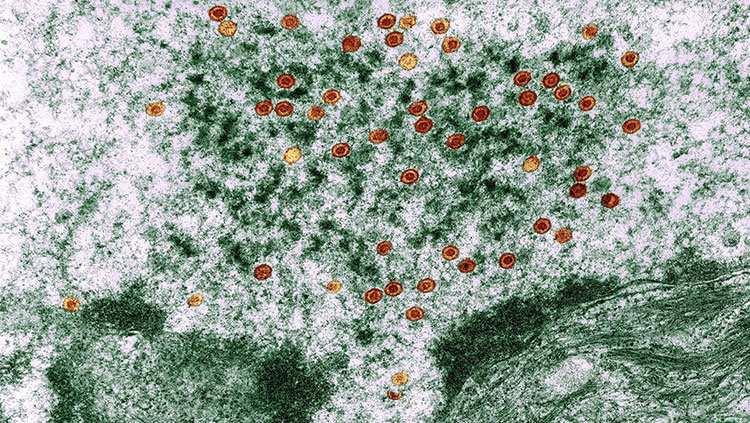 Herpes simplex viruses in cell nucleus