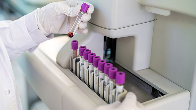 Hand with gloves holding test tubes