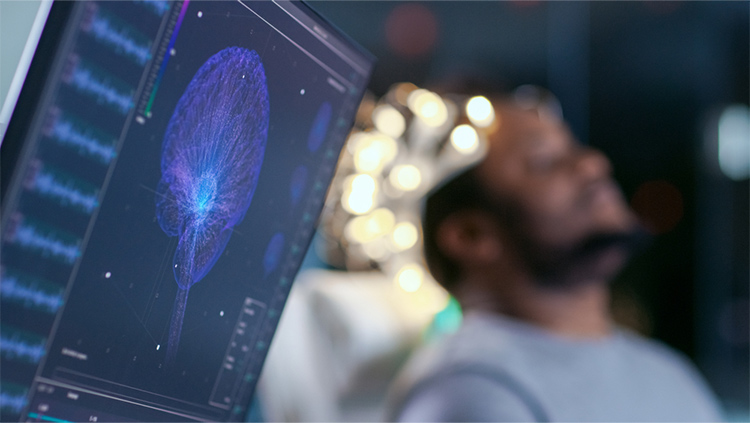 Man laying down with brain scan on computer screen