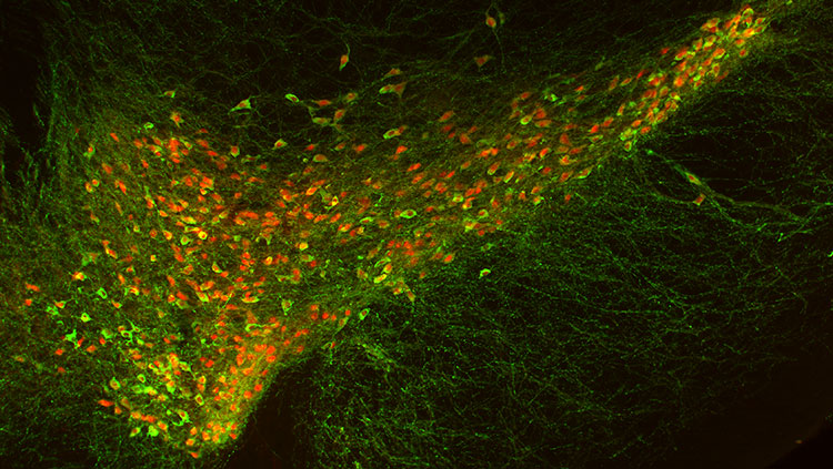 Image of neurons