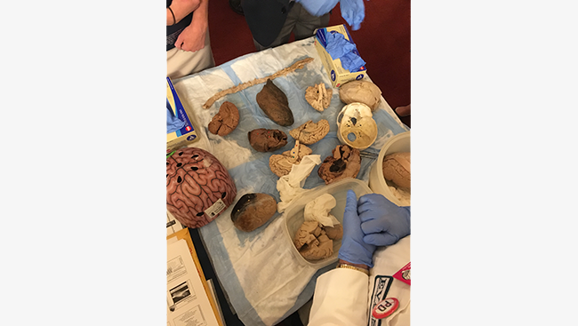 Visitors to the Public Health Fair view and touch specimens of the human brain, heart, lungs, and spinal cord.