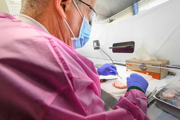 Woman in lab with brain sample