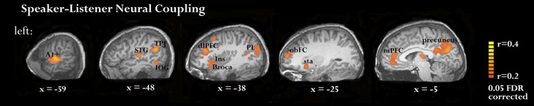 images of brain scans