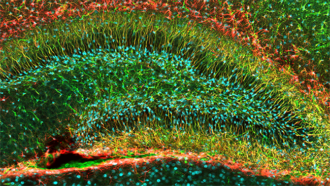 This image of a mouse dentate gyrus shows newborn cells (blue) and the support cells called glia (red) that will help them migrate to their final destinations. 