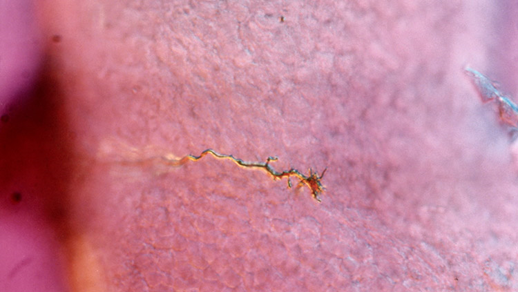 Image of a growth cone