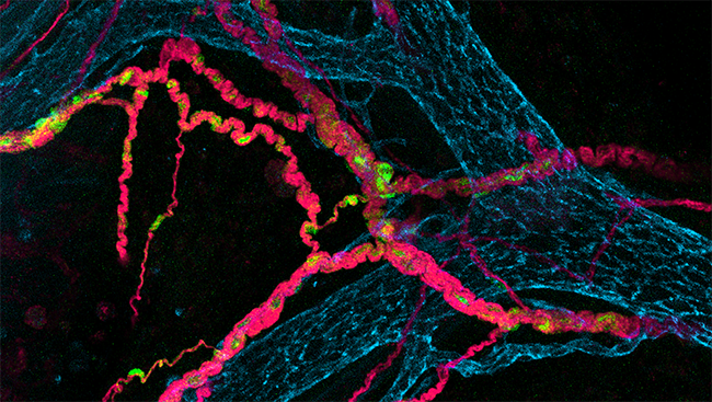 This image shows the enteric nervous system of a four-day-old mouse, with blood and lymphatic vessels (blue), neurons (pink), and support cells called Schwann cells (green). 
