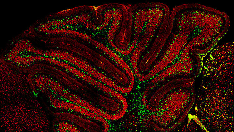 Mouse cerebellum