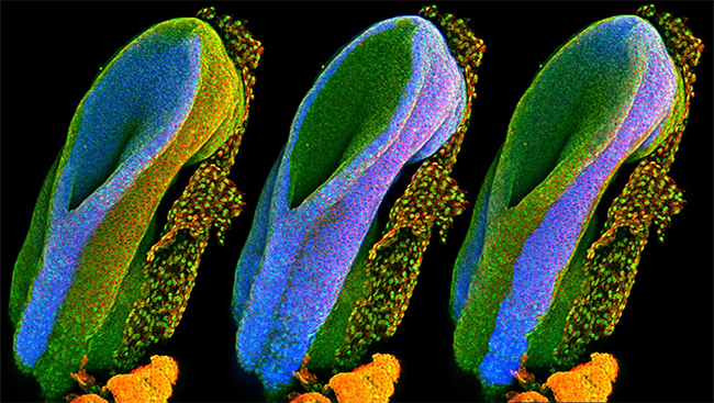 The mouse embryos depicted in this image highlight each of these tissues in blue. The image on the left shows the neural tube, which will form the brain and spinal cord. The middle image highlights tissue that will develop into all of the body’s internal organs, and the right image shows tissue that will later become hair, skin, and teeth.