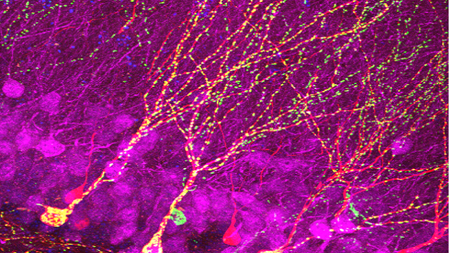Image of a mouse hippocampus (magenta), new cells are labelled in red, and mitochondria— the intracellular power packs responsible for driving cellular activities throughout the body — are labelled in green.