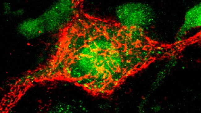 Image of a perineuronal net around a nerve cell.