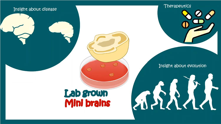 Lab grown mini brain thumbnail