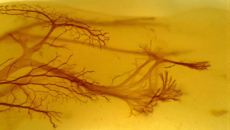 Embryonic nerves growing into the developing limb