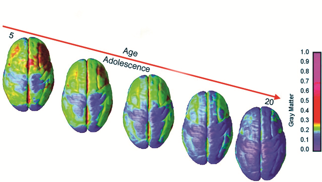 Brain images showing change affected by age