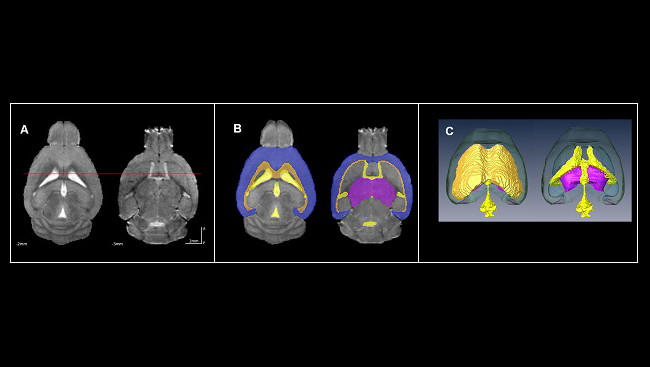 MRI images of the brains of mice exposed to alcohol