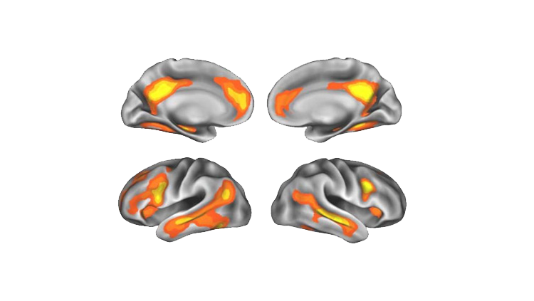 Images of brain during motherood