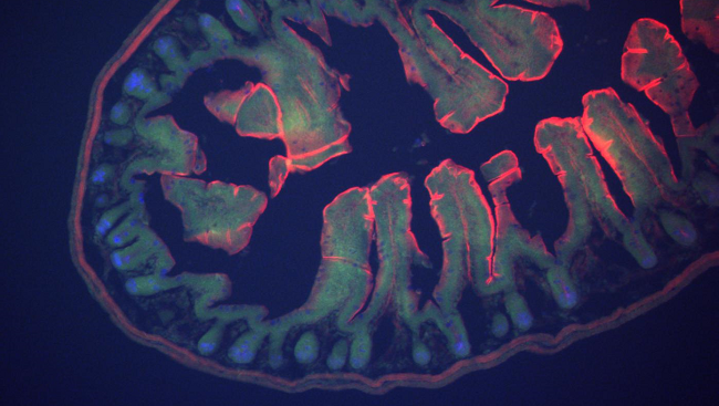 In a mouse model of autism, Sarkis Mazmanian and his team of researchers at Caltech corrected the leaky gut that is often associated with the disorder by treating the mice with Bacteriodes fragilis. Mice that received treatment also exhibited fewer behaviors associated with autism, such as anxiety.