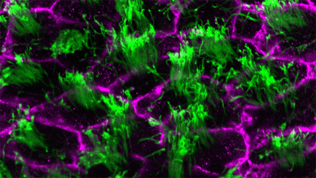 This image shows the cells (purple) lining the ventricles in the brain of an adult mouse. These cells have tiny hair-like projections called cilia (green) that beat in the same direction to enable the flow of CSF. 
