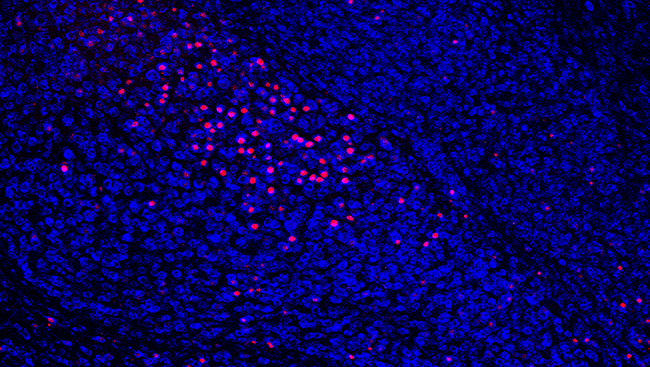 This image shows a cross-section of the amygdala of a young mouse, with individual neurons stained in blue. Prior to staining, the mouse completed an anxiety-provoking task which activated a small group of neurons (pink dots).