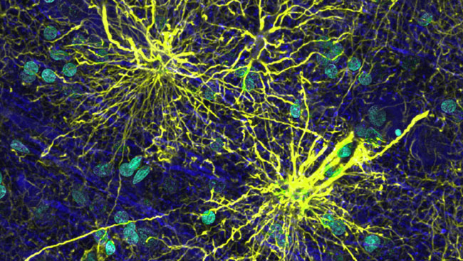 Human temporal lobe cortex immunolabeled for astrocytes (GFAP; yellow), neurons (MAP2; blue), and nuclei (DAPI; green) shows protoplasmic astrocytes and a varicose projection astrocyte, a novel glial type. 