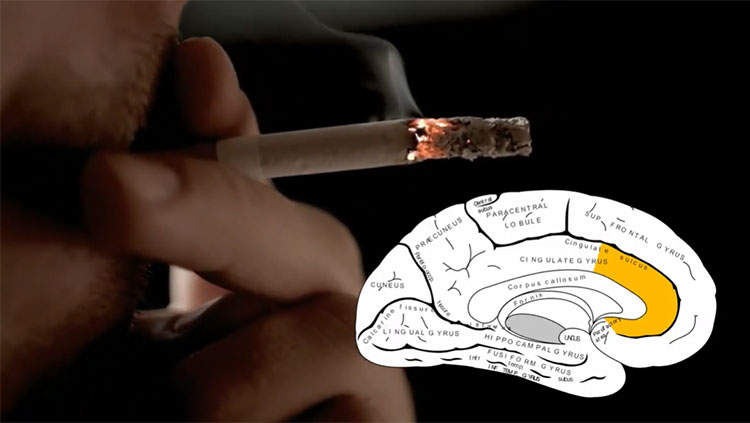 Cigarette and the brain