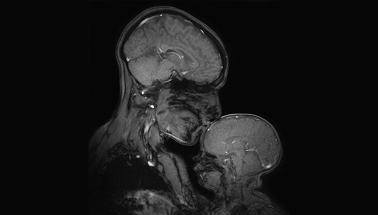 MRI image of a mother with child