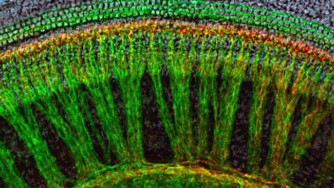 The cells in the cochlea are arranged like a wagon wheel, as seen above in a mouse. The green “spokes” carry signals to the brain while the cells in red send signals back from the brain to the cochlea. Scientists now know that the cells in red are particularly important for protecting hearing. 