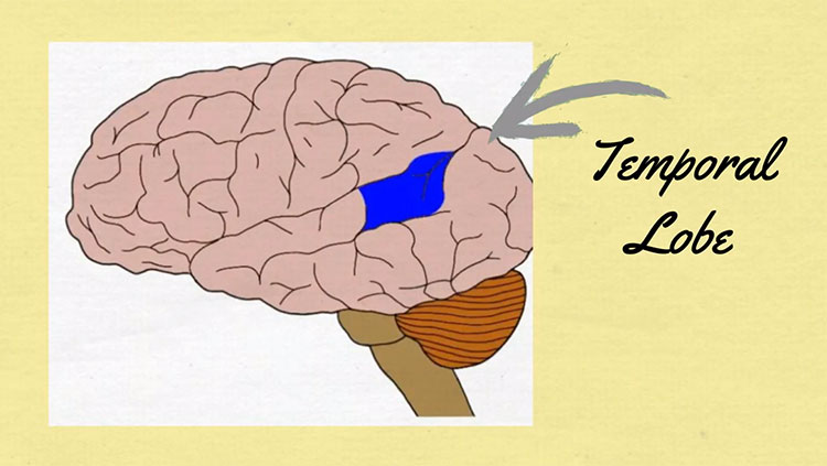 Image showing temporal lobe