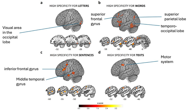 Areas of the brain