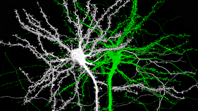 Dendritic spines.