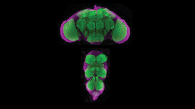The image above shows a front-view of a fly brain (top) and part of the spinal cord (bottom), with synapsin-containing synapses (green) and neuron cell bodies (magenta).