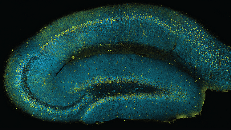 image of a mouse hippocampus