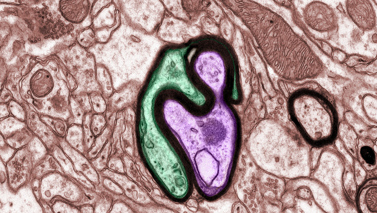 purple and green nerve fibers in mouse medial prefrontal cortex