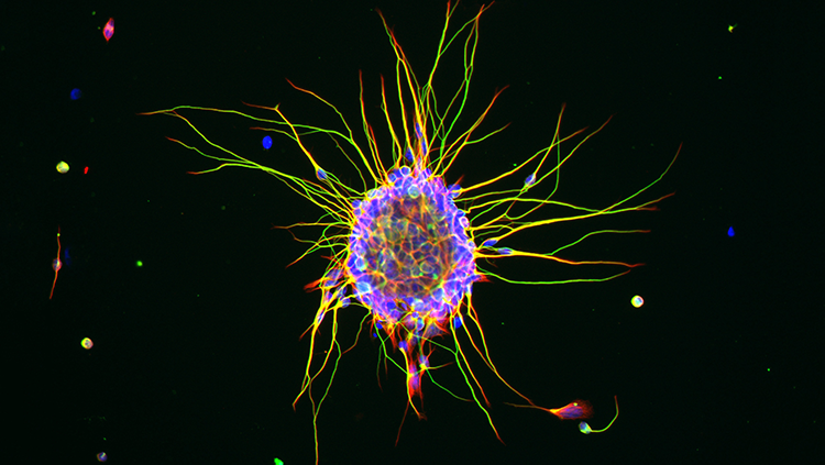 Image of a cerebellar granule cell