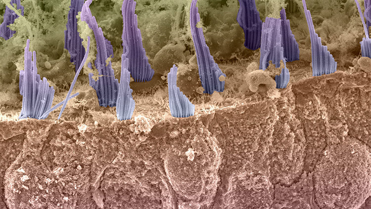 Image of hair cells