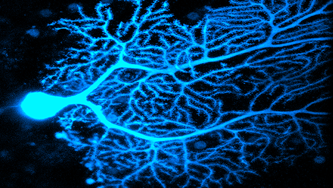 Intricately-branched neurons called Purkinje cells call the cerebellum home.  Among the largest cells in the brain, Purkinje cells — like the one seen here in a mouse — regulate activity in the cerebellum and help us coordinate our movements. 