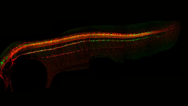image of glycinergic neuron orange green